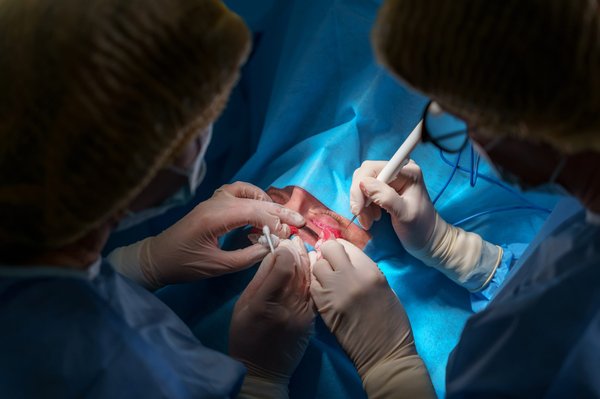 Les secrets de la blépharoplastie supérieure à bordeaux pour un regard captivant